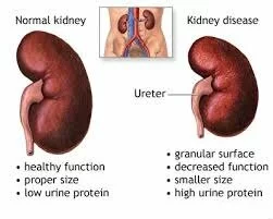 kidney p