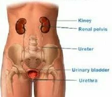 8 Ways to Prevent Urinary Tract Infections (UTI)