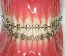 Nigeria has only 41 orthodontists for 180 million citizens.